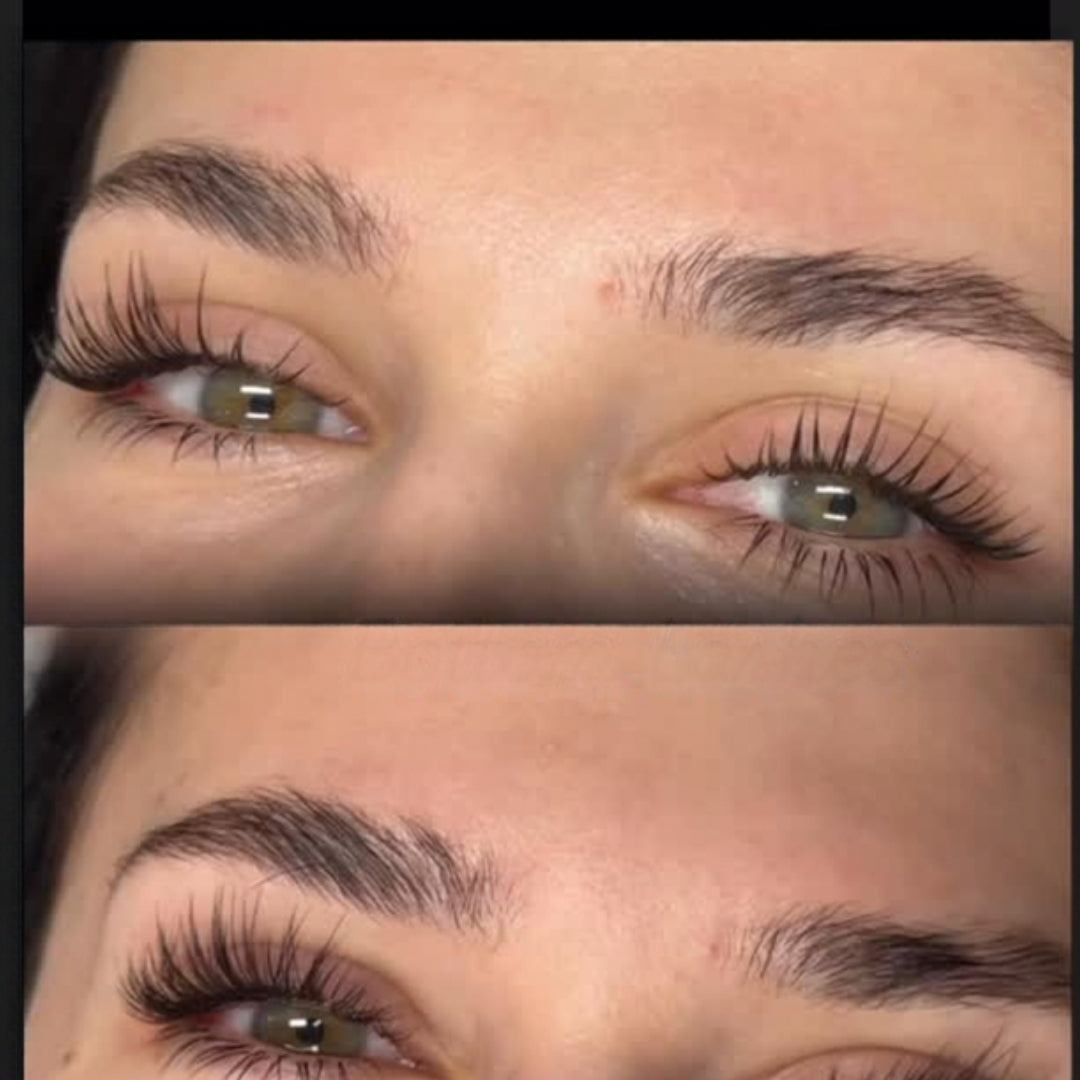 Cameo Clinic - Under-Eye Treatment