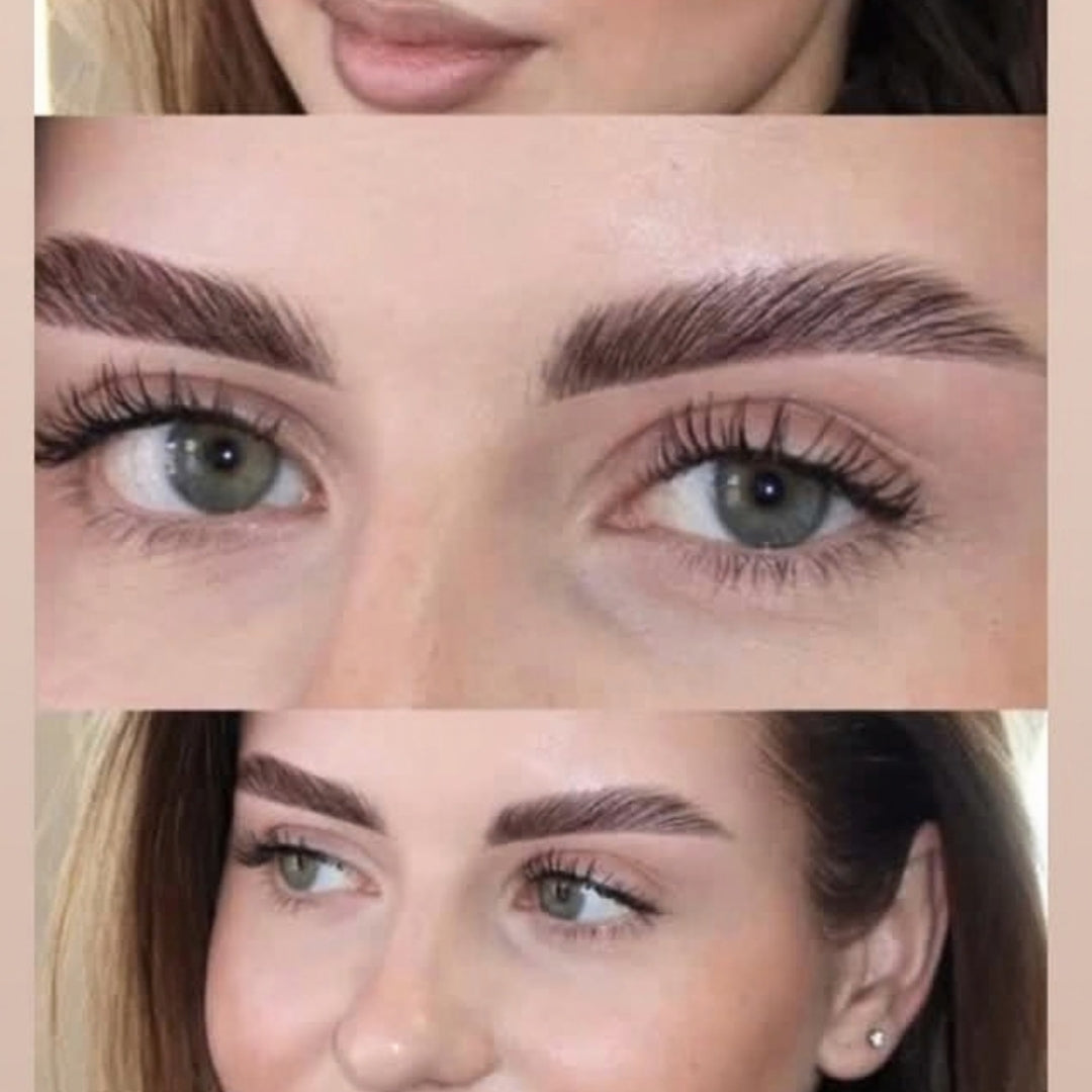 Cameo Clinic - Under-Eye Treatment