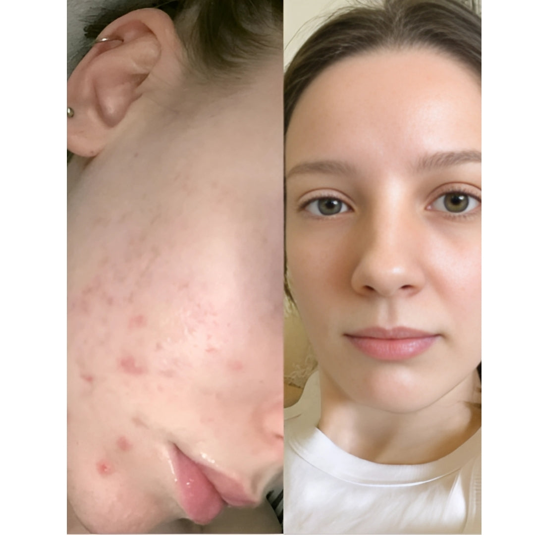 Facials By HOUSE OF HM